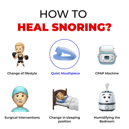 Honex® Pro Anti-Snoring Mouthpiece